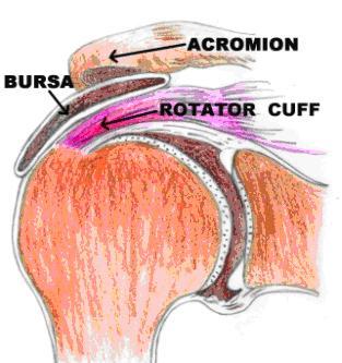 Shoulder Rotator Cuff Repair