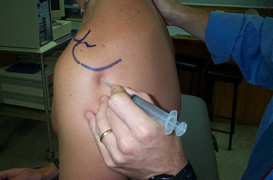 What Are Side Effects Of Cortisone Shot In Shoulder