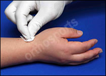 Injury Basal Thumb Education