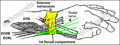 Superficial radial nerve branches. 