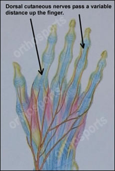 Injury Intermetacarpal Education