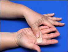 Injury Intermetacarpal Education