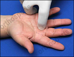 Injury Trigger Finger Education