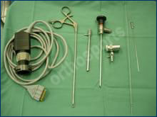 Hip Arthroscopy