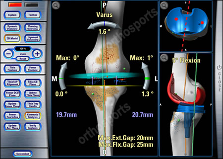 Orthosports Sydney