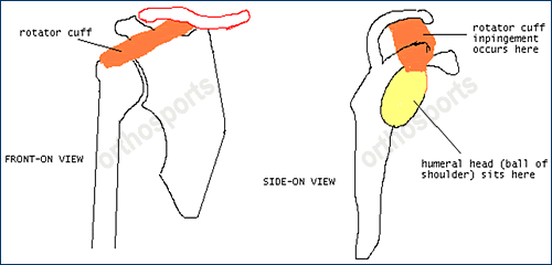 shoulder impingement symptoms